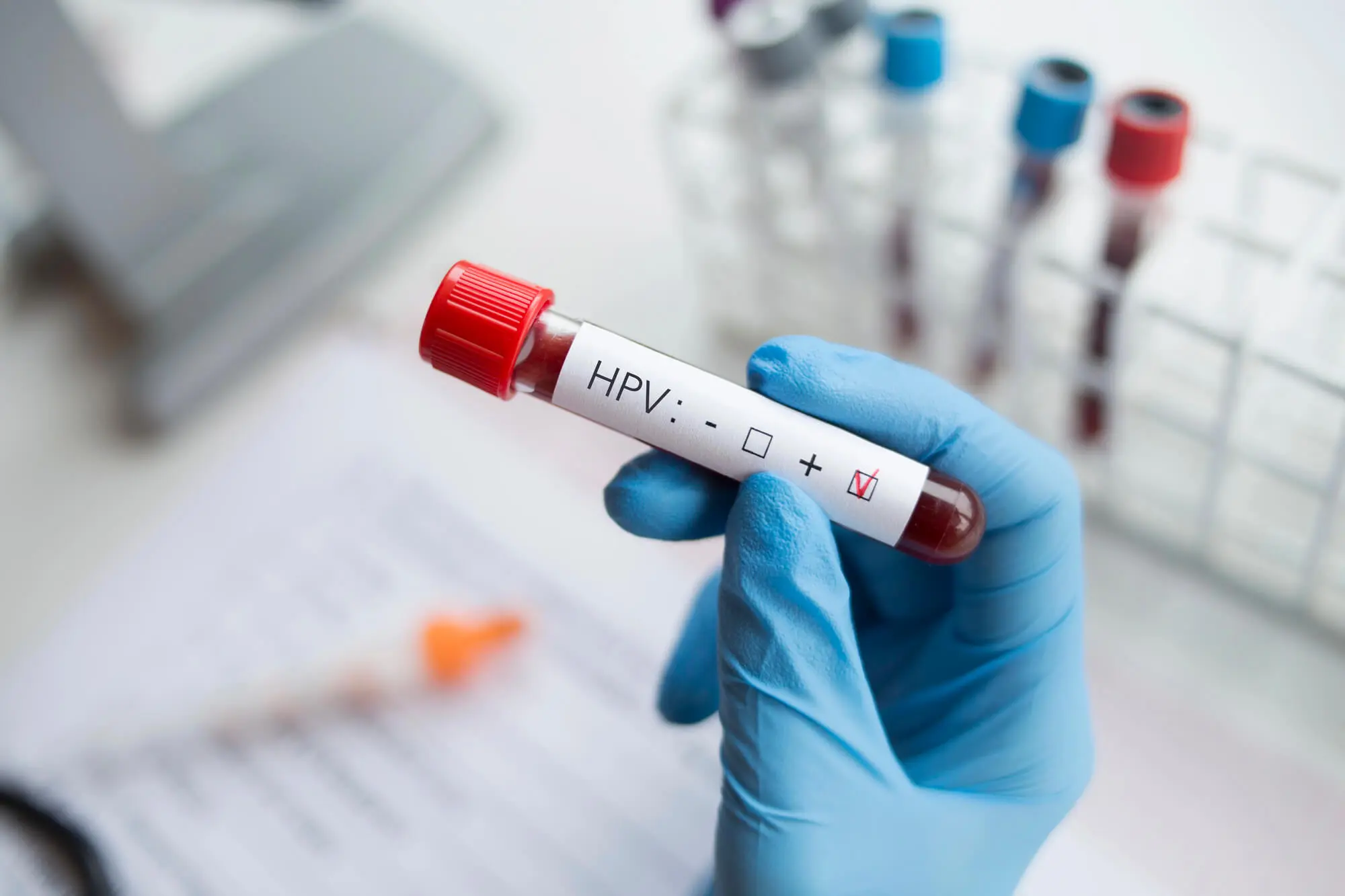 Dentist in Concord Explain Who's at Risk of Oral Cancer