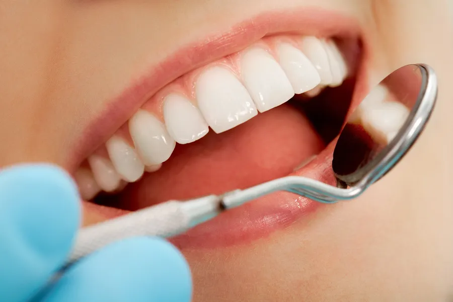 dental exam Concord CA dental care